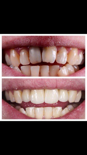 photo_2015-02-27_14-52-37